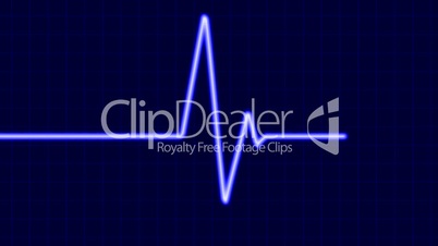 Cardiogram. Six seconds loop.