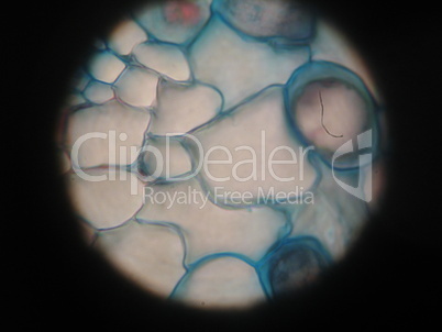 Microscopic view of pine needle, 200x