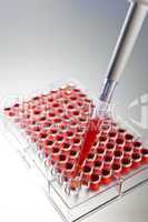 Blood Sample Scientific Research With a Pipette and Cell Plate