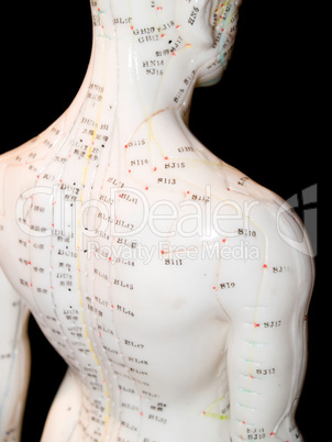 Acupuncture Concept