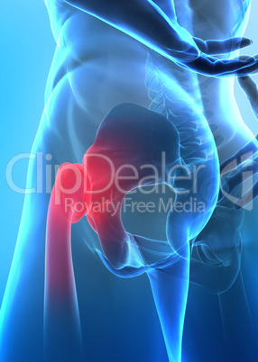 Pain in hip concept