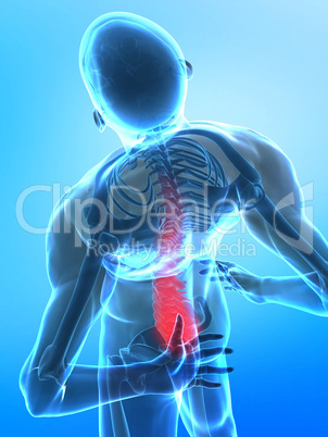 Pain in spine concept