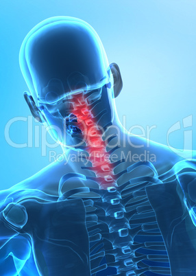 Pain in cervical spine concept