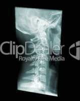 x-ray spine