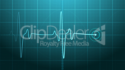 EKG - Electrocardiogram