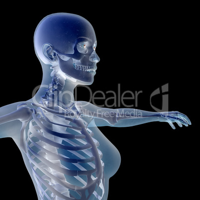 weibliche Oberkörper Röntgenbild