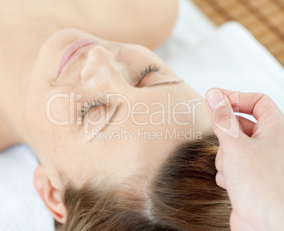 Acupuncture needles on an attractive woman's head