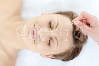 Acupuncture needles on a relaxed woman's head