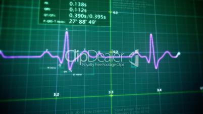 EKG monitor loop