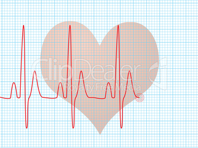 heart beat medical