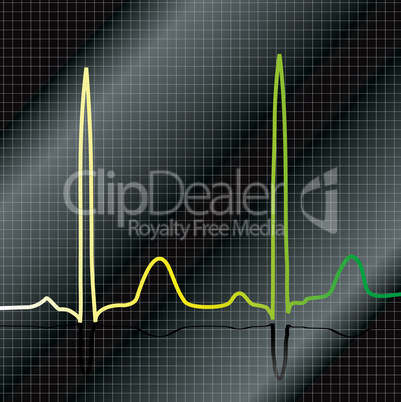 gradient ecg