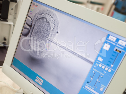 Monitor showing intra cytoplasmic sperm injection