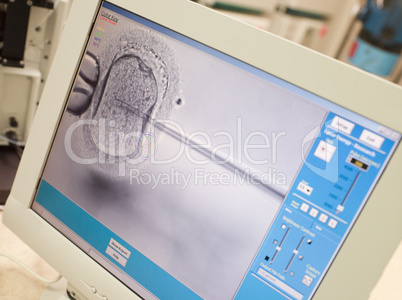 Monitor showing intra cytoplasmic sperm injection