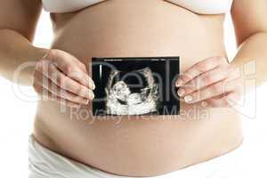 Werdende Mutter hält ein Ultraschallbild vor den Bauch