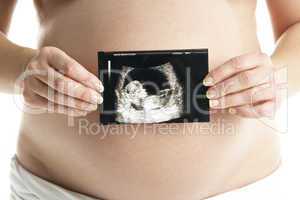 Werdende Mutter hält ein Ultraschallbild vor den Bauch