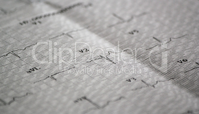 Electrocardiogram