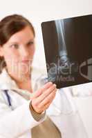 Female doctor holding x-ray