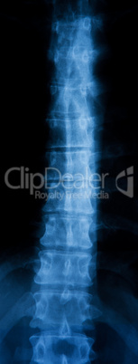 Spinal X-Ray Image