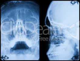 X-Ray Skull Front And Side Profile
