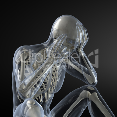 Head Pain X-ray concept