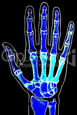 blaue Knochen/ blue bones Hand