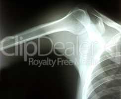Shoulder joint x-ray