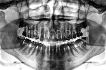 dental scan x-ray