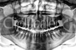 dental scan x-ray