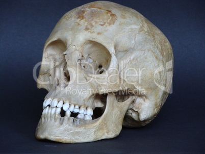 3/4 photo of real human skull