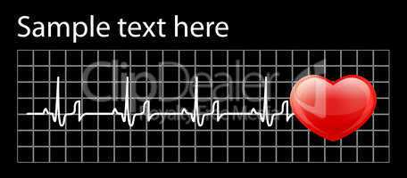 Heart cardiogram