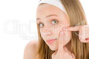 Acne facial care teenager woman squeezing pimple