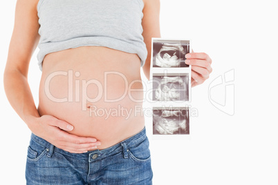 Pregnant woman showing an ultrasound scan while standing