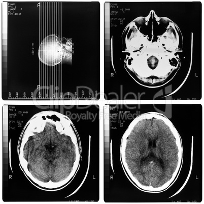 Medical Xray