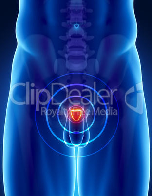 Prostate cancer concept