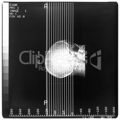 Medical Xray