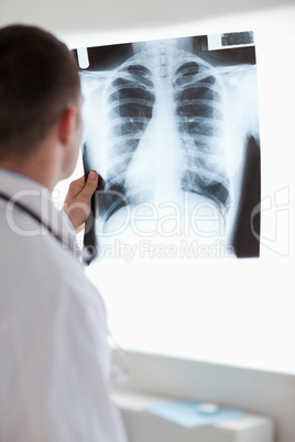 Close up of doctor using light to check x-ray