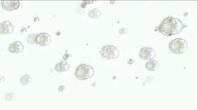 virus and microbe under microscope,cells plankton,bubble soap,seed spore.