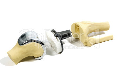 plastic model of a knee replacement