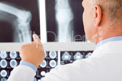 Mature doctor male point at set x-ray