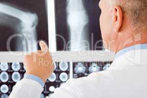 Mature doctor male point at set x-ray