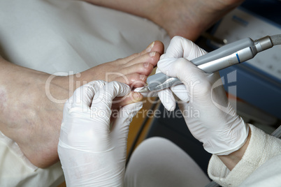 Medizinische Fußpflege - Foot care - Chiropody
