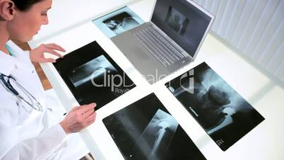 Ärztin mit den Röntgenbildern
