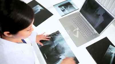 Ärztin mit den Röntgenbildern