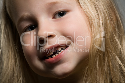 little girl without a front tooth
