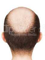 Bald men head