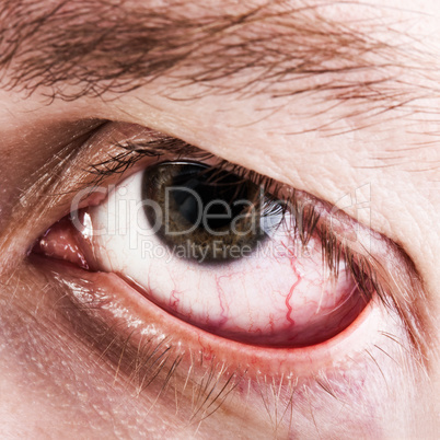 Blood capillary human eye