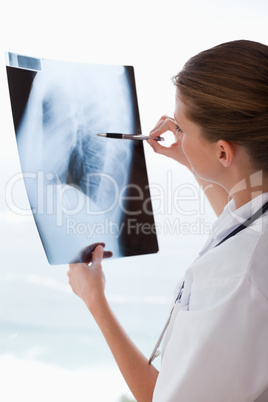 Doctor with x-ray