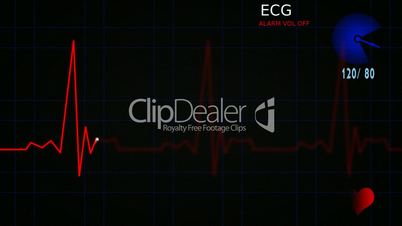 EKG heart monitor