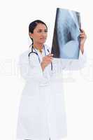 Female physician checking x-ray