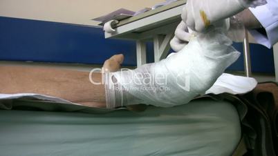 Doctor bandaging diabetic foot